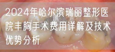 2024年哈尔滨瑞丽整形医院丰胸手术费用详解及技术优势分析