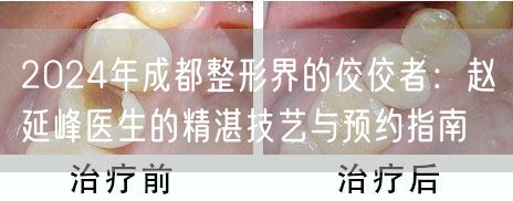 2024年成都整形界的佼佼者：赵延峰医生的精湛技艺与预约指南