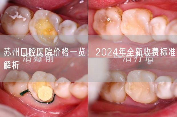 苏州口腔医院价格一览：2024年全新收费标准解析