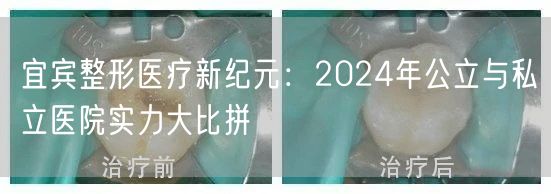 宜宾整形医疗新纪元：2024年公立与私立医院实力大比拼