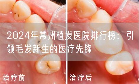2024年常州植发医院排行榜：引领毛发新生的医疗先锋