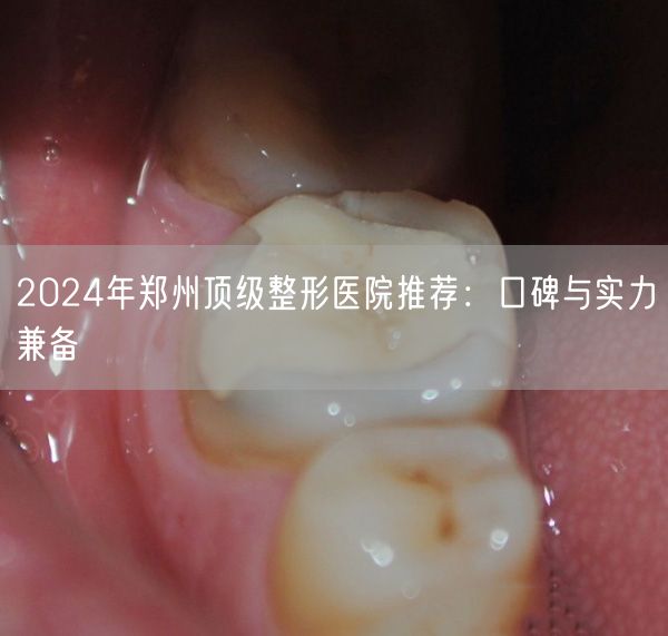 2024年郑州顶级整形医院推荐：口碑与实力兼备