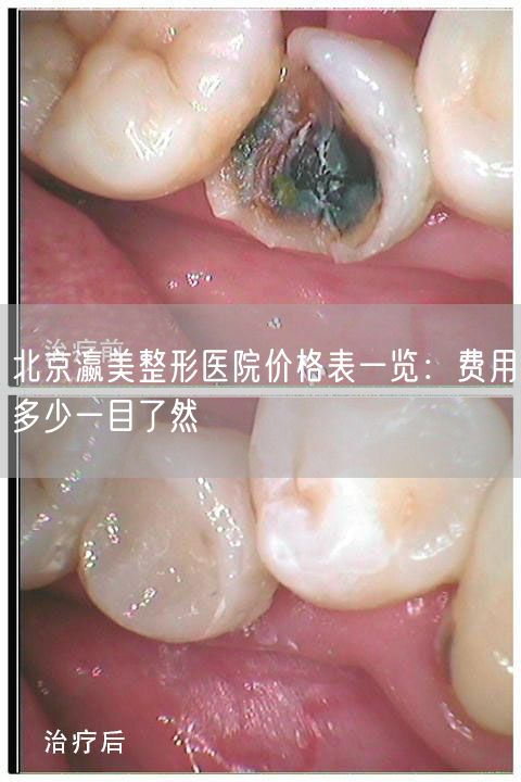 北京瀛美整形医院价格表一览：费用多少一目了然