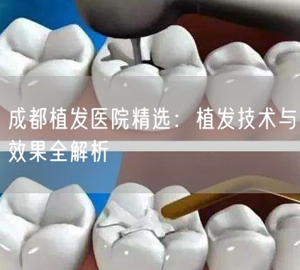 成都植发医院精选：植发技术与效果全解析
