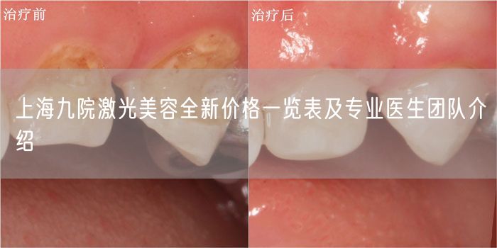 上海九院激光美容全新价格一览表及专业医生团队介绍