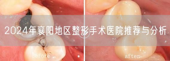 2024年襄阳地区整形手术医院推荐与分析