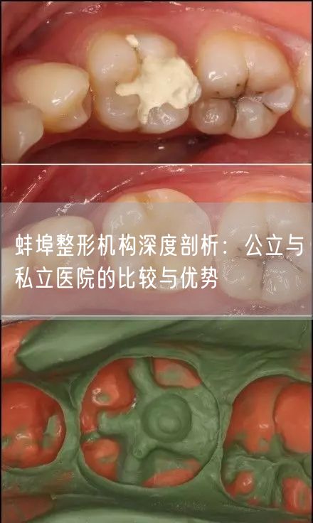 蚌埠整形机构深度剖析：公立与私立医院的比较与优势