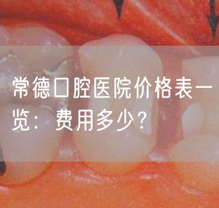 常德口腔医院价格表一览：费用多少？