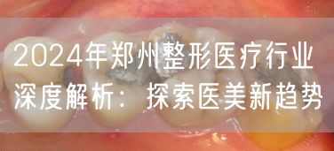 2024年郑州整形医疗行业深度解析：探索医美新趋势