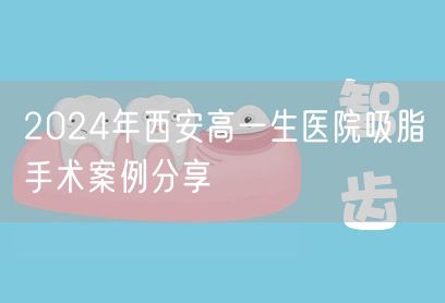 2024年西安高一生医院吸脂手术案例分享