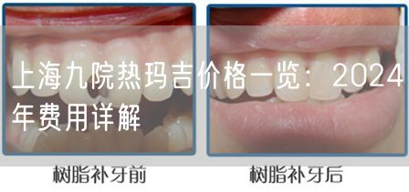 上海九院热玛吉价格一览：2024年费用详解