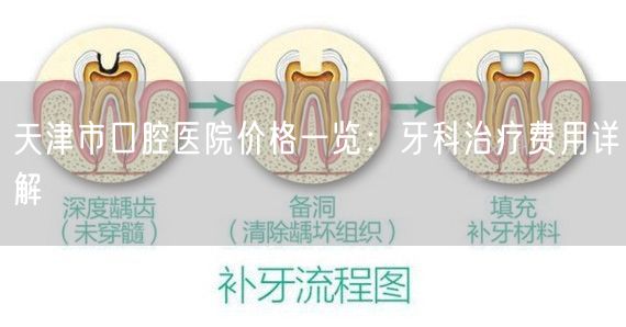 天津市口腔医院价格一览：牙科治疗费用详解