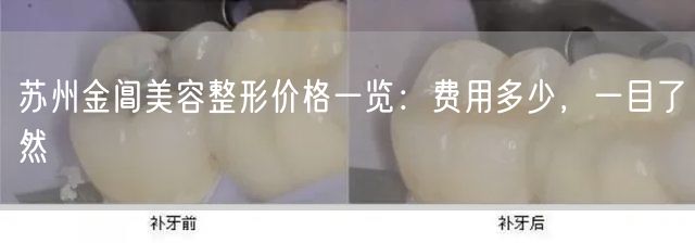 苏州金阊美容整形价格一览：费用多少，一目了然