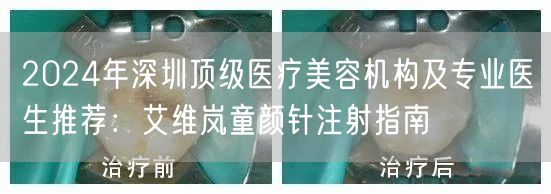 2024年深圳顶级医疗美容机构及专业医生推荐：艾维岚童颜针注射指南