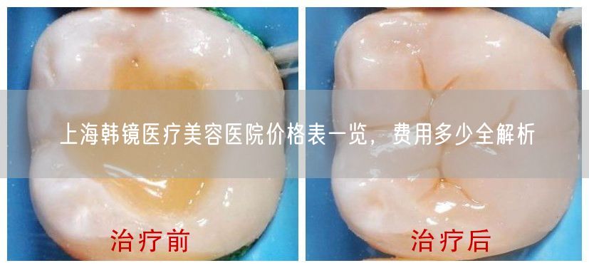 上海韩镜医疗美容医院价格表一览，费用多少全解析