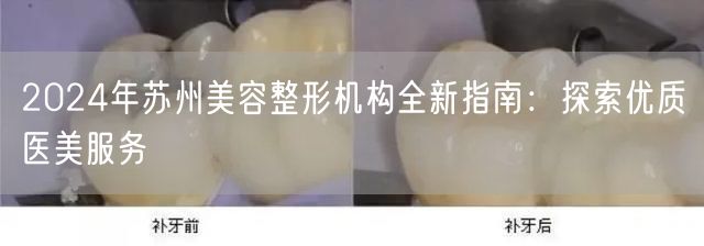 2024年苏州美容整形机构全新指南：探索优质医美服务