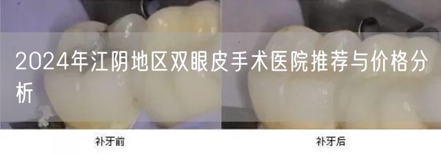 2024年江阴地区双眼皮手术医院推荐与价格分析