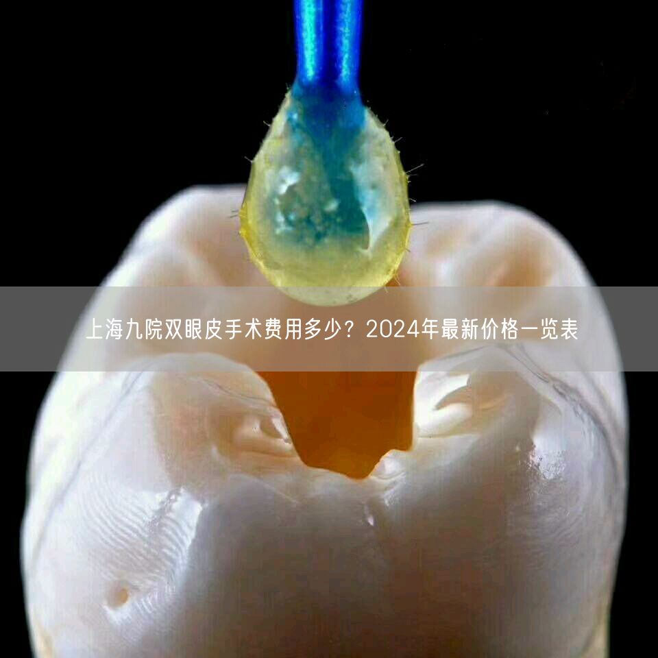 上海九院双眼皮手术费用多少？2024年最新价格一览表