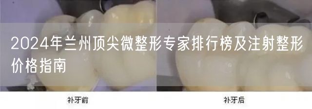 2024年兰州顶尖微整形专家排行榜及注射整形价格指南