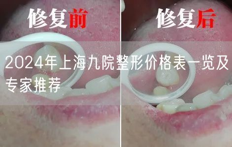 2024年上海九院整形价格表一览及专家推荐