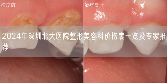 2024年深圳北大医院整形美容科价格表一览及专家推荐