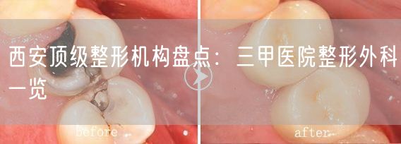 西安顶级整形机构盘点：三甲医院整形外科一览