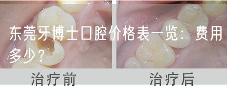 东莞牙博士口腔价格表一览：费用多少？