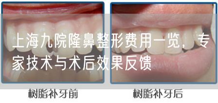 上海九院隆鼻整形费用一览，专家技术与术后效果反馈