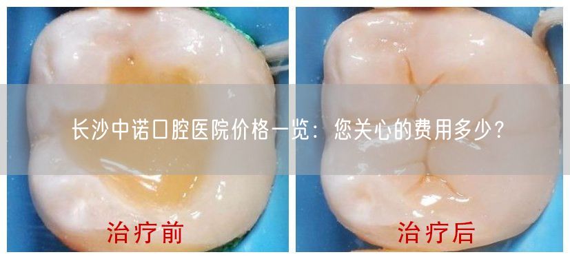 长沙中诺口腔医院价格一览：您关心的费用多少？
