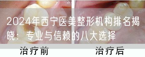 2024年西宁医美整形机构排名揭晓：专业与信赖的八大选择