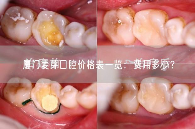 厦门麦芽口腔价格表一览：费用多少？
