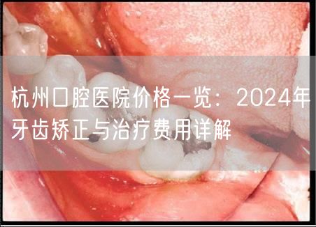 杭州口腔医院价格一览：2024年牙齿矫正与治疗费用详解