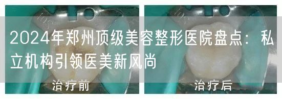 2024年郑州顶级美容整形医院盘点：私立机构引领医美新风尚