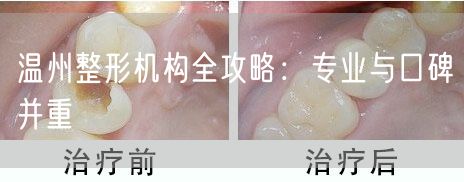 温州整形机构全攻略：专业与口碑并重
