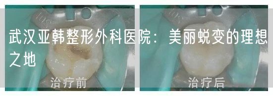 武汉亚韩整形外科医院：美丽蜕变的理想之地