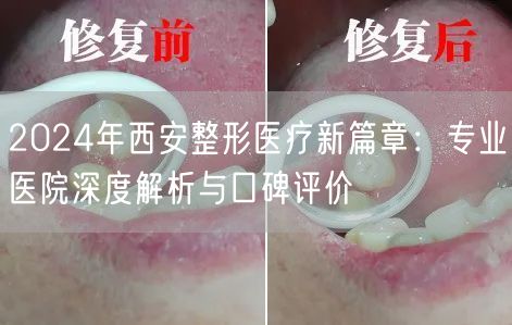 2024年西安整形医疗新篇章：专业医院深度解析与口碑评价