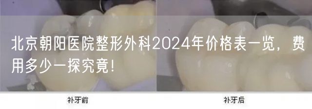 北京朝阳医院整形外科2024年价格表一览，费用多少一探究竟！