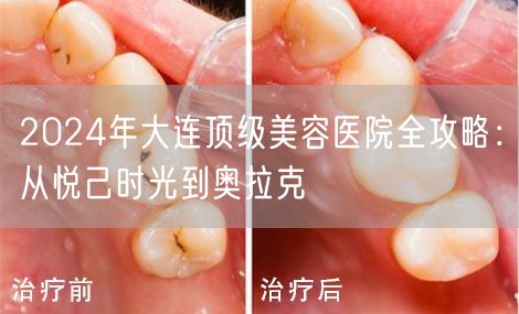 2024年大连顶级美容医院全攻略：从悦己时光到奥拉克