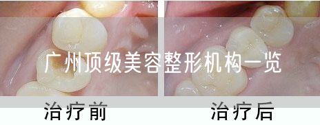 广州顶级美容整形机构一览
