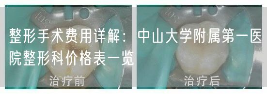 整形手术费用详解：中山大学附属第一医院整形科价格表一览