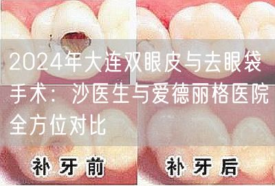2024年大连双眼皮与去眼袋手术：沙医生与爱德丽格医院全方位对比