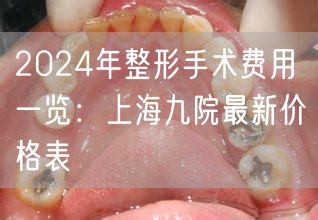 2024年整形手术费用一览：上海九院最新价格表