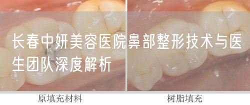 长春中妍美容医院鼻部整形技术与医生团队深度解析