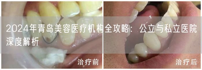 2024年青岛美容医疗机构全攻略：公立与私立医院深