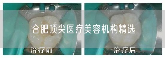 合肥顶尖医疗美容机构精选