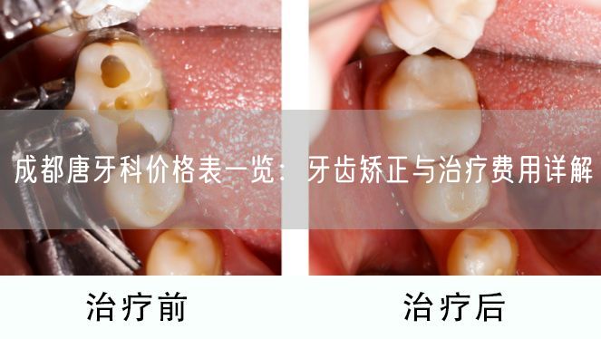 成都唐牙科价格表一览：牙齿矫正与治疗费用详解