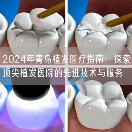 2024年青岛植发医疗指南：探索顶尖植发医院的先进技术与服务