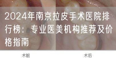 2024年南京拉皮手术医院排行榜：专业医美机构推荐及价格指南