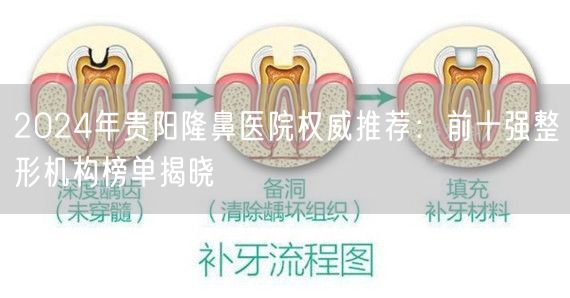 2024年贵阳隆鼻医院权威推荐：前十强整形机构榜单揭晓