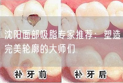 沈阳面部吸脂专家推荐：塑造完美轮廓的大师们